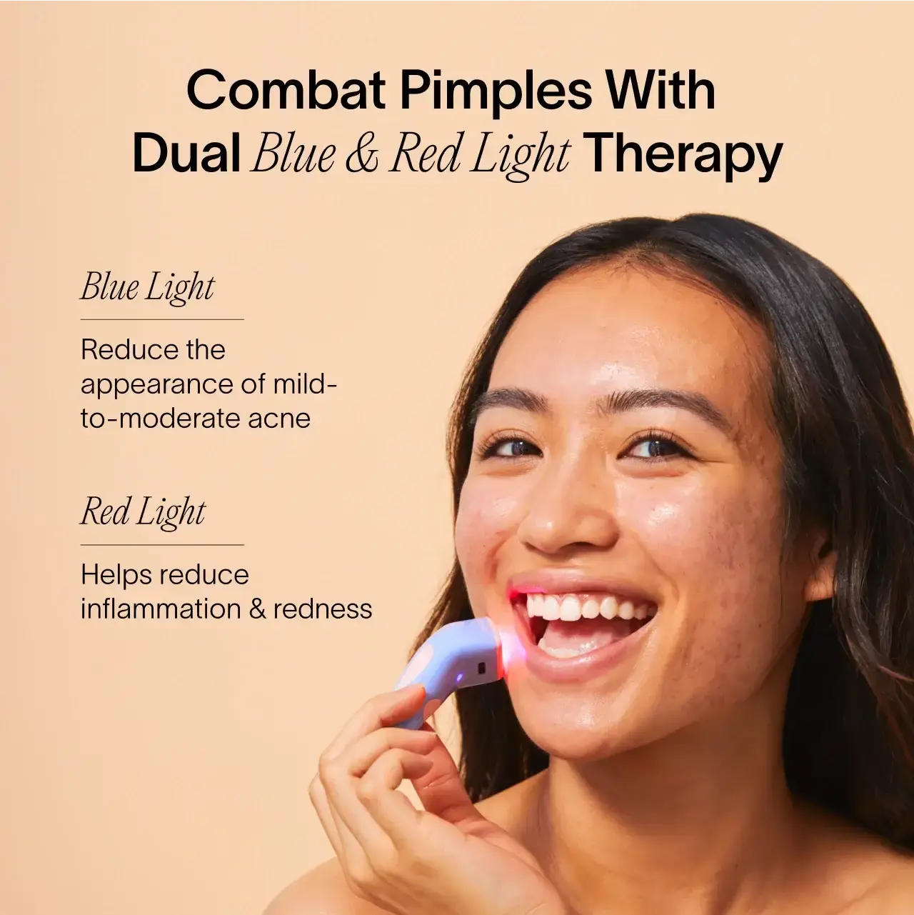 Bye Acne: 3-Minute Pimple Spot Treatment Plush Fashion Hub